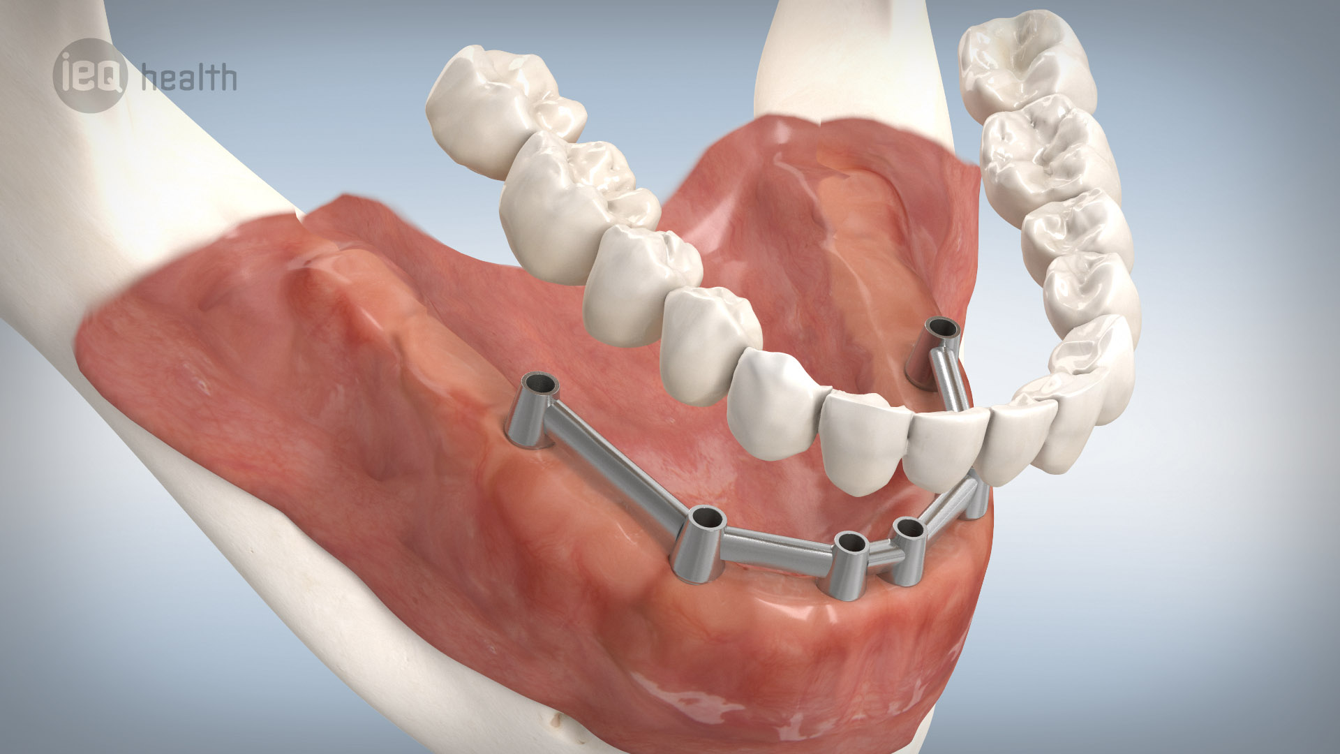 “Smile 3D“ Animationen